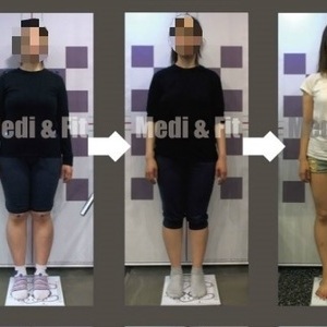 김○○회원님 before & After [메디앤핏 약수점]   