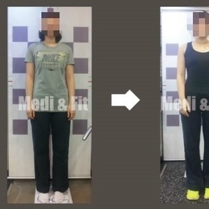 최○○회원님 before&after [메디앤핏 약수점]